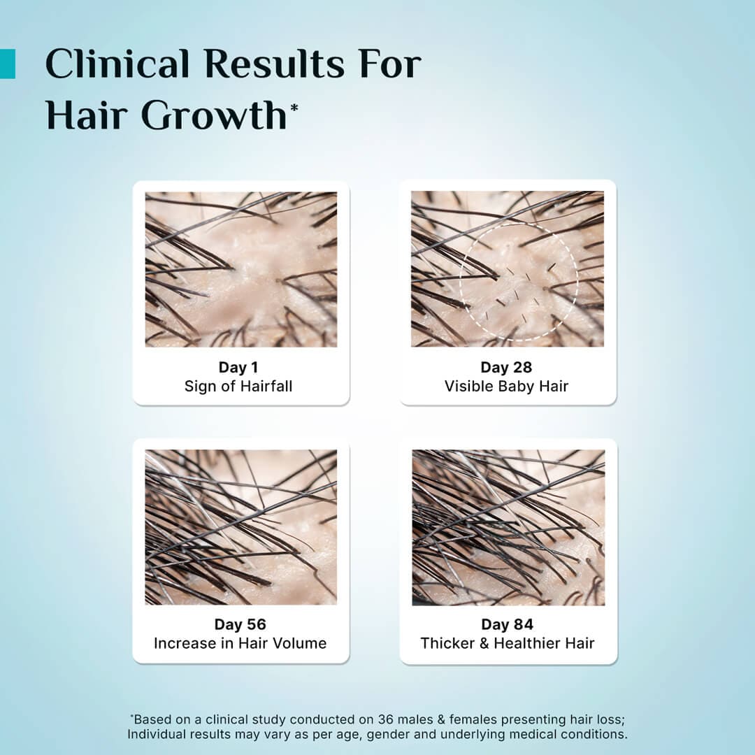 3% Redensyl, 4% Anagain & 5% Capilia Stem Cell Complex Advanced Hair Growth Serum