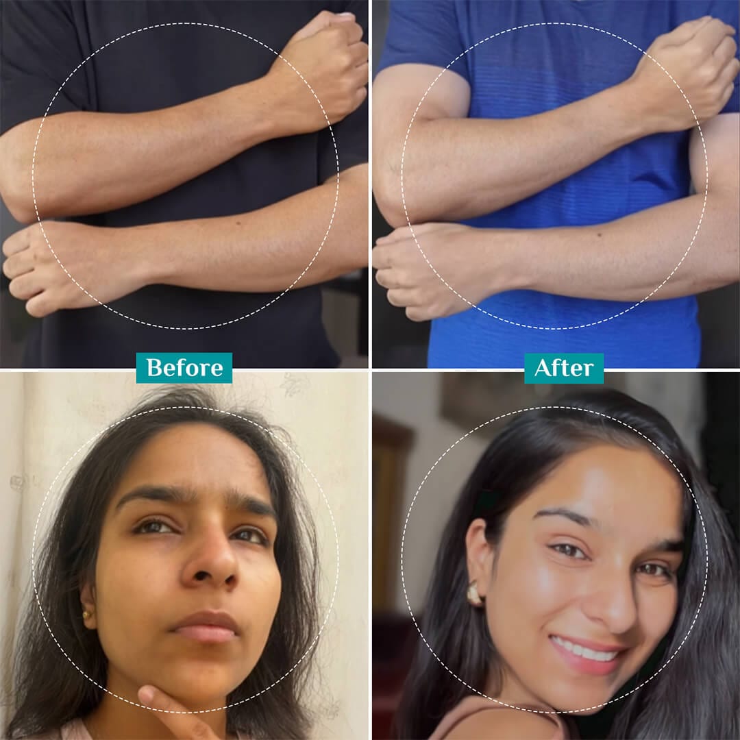 25% AHA, 2% BHA, 5% PHA Peeling Solution