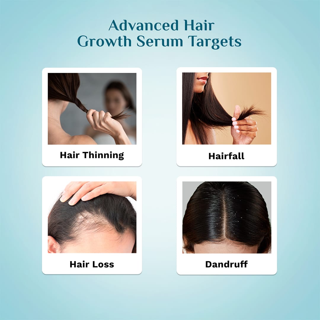 3% Redensyl & 4% Anagain Advanced Hair Growth Serum For Dandruff-Prone Scalp - 30 ml