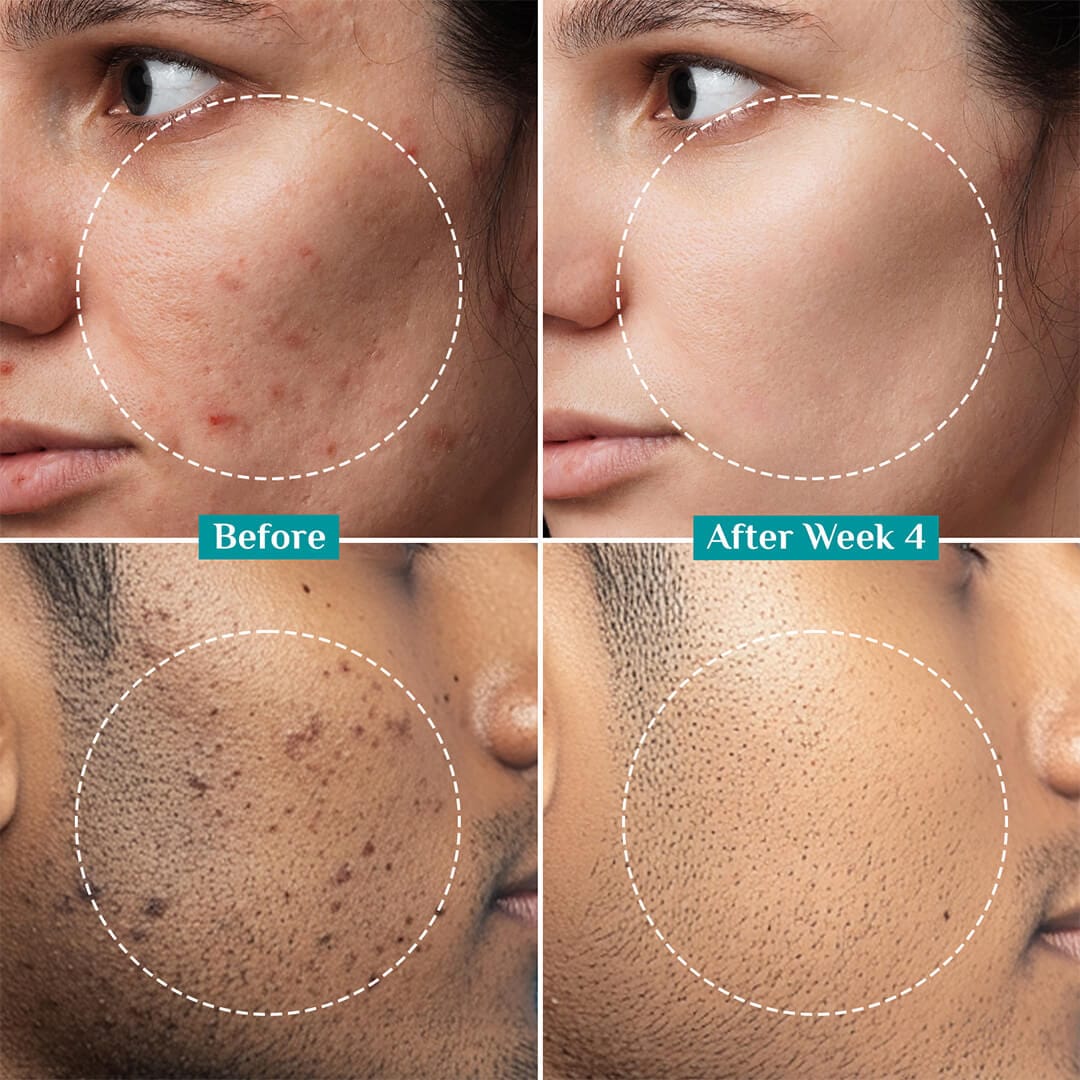 Brightening Serum & Face Cream Combo