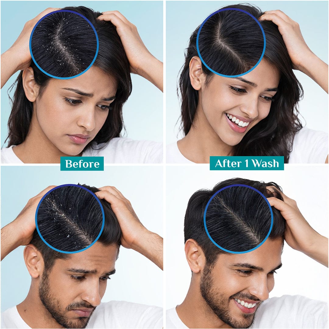 Australian Tea Tree Non-Drying Anti-Dandruff Shampoo Cool Menthol