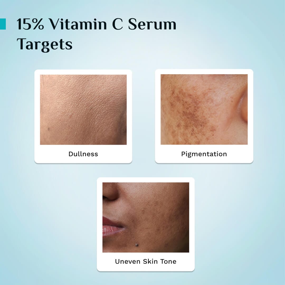 15% Vitamin C Face Serum For Advanced Brightness (20 ml)