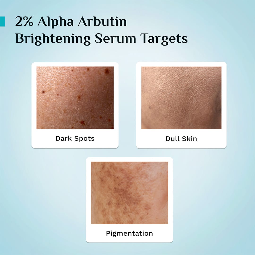 2% Alpha Arbutin Brightening Serum