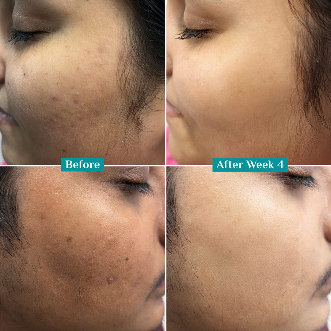 10% Niacinamide Face Serum With Kojic Acid & Korean Rice Water