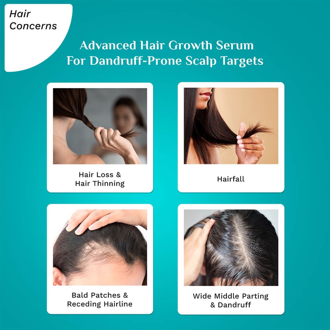 3% Redensyl & 4% Anagain Advanced Hair Growth Serum For Dandruff-Prone Scalp - 30 ml