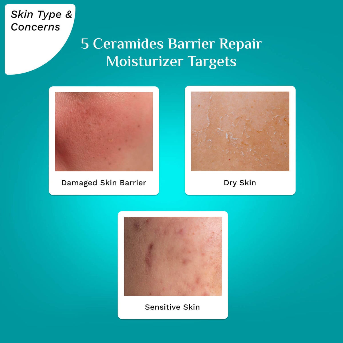 Buy 5 Ceramides Barrier Repair Moisturizer