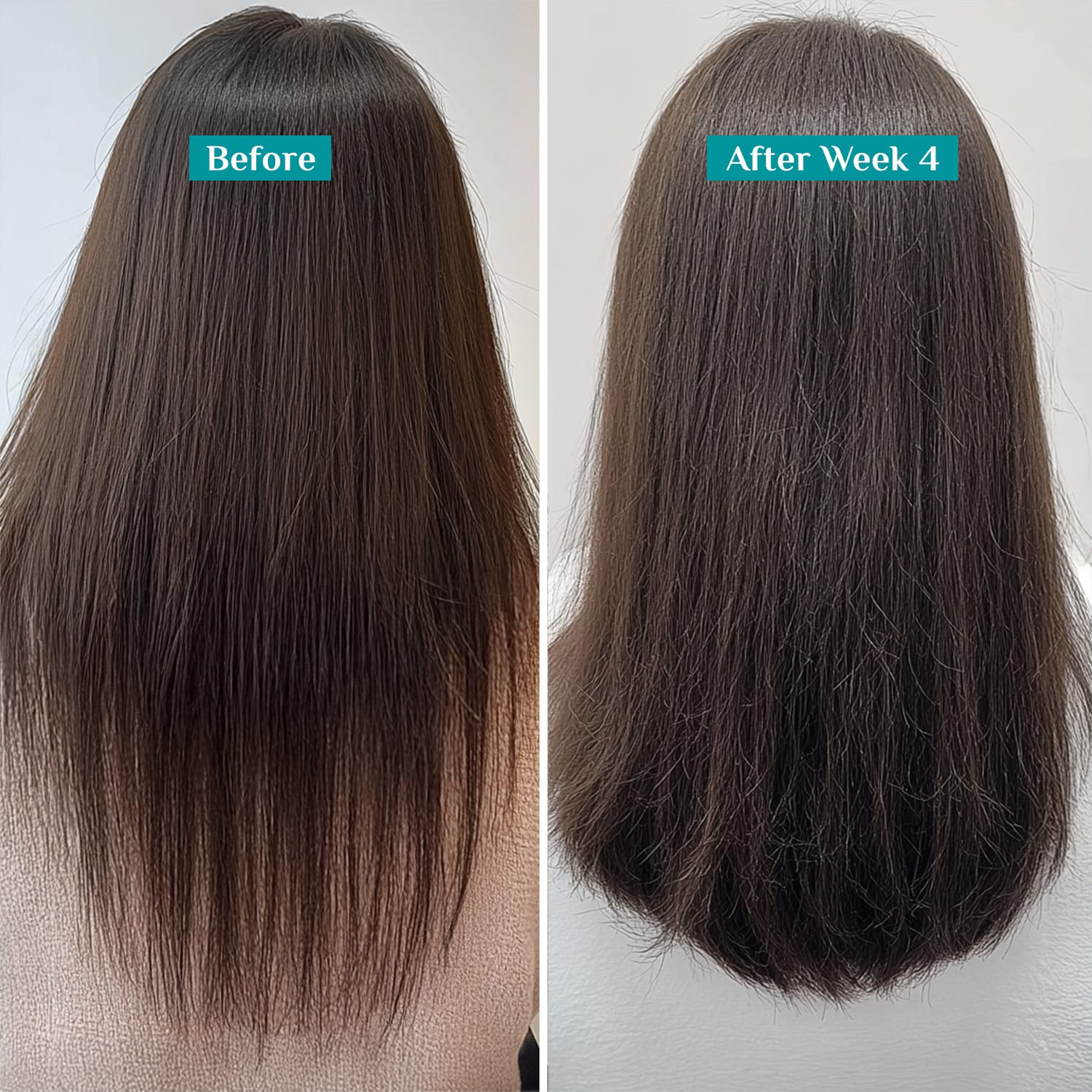 Redensyl & Anagain Hairfall Control Shampoo - 400ml