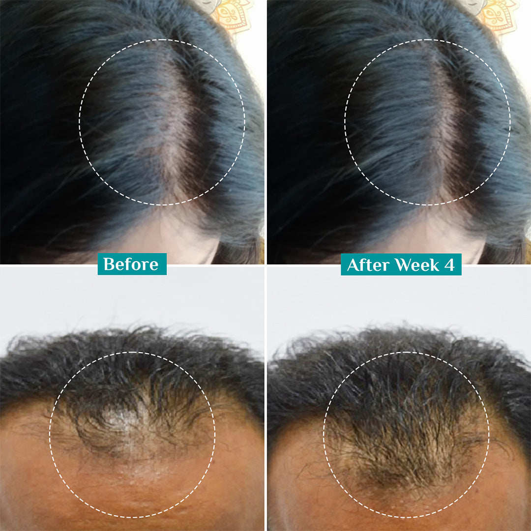 3% Redensyl + 4% Anagain Hair Growth Serum