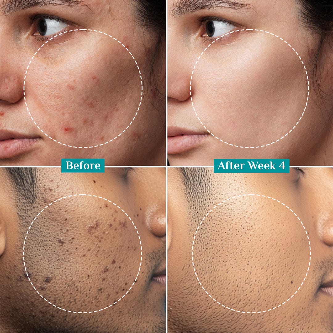 2% Alpha Arbutin Brightening Serum for Men