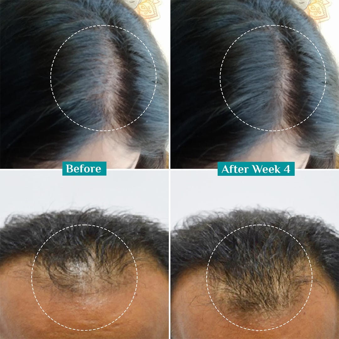 3% Redensyl & 4% Anagain Advanced Hair Growth Serum 100 ml