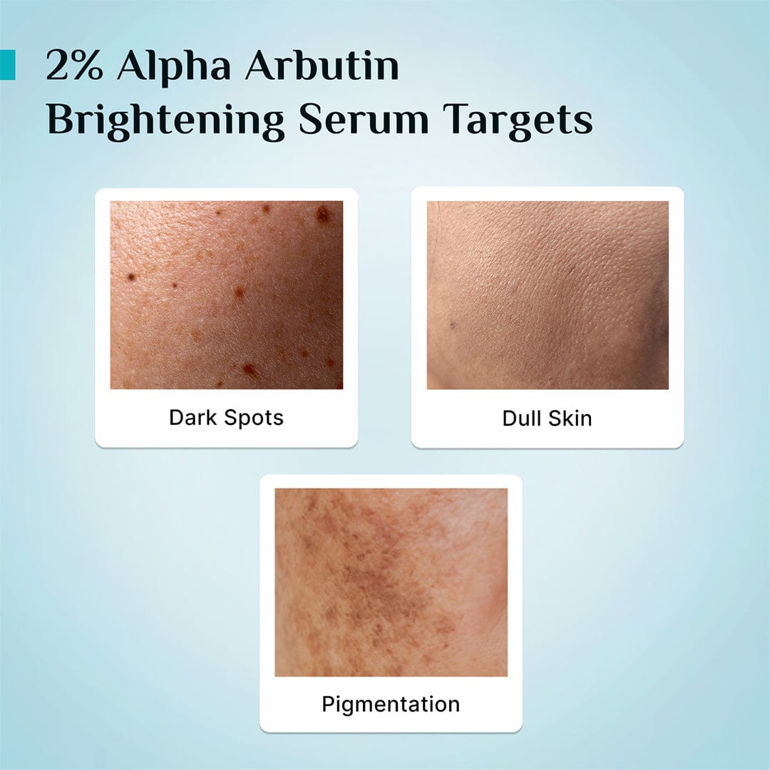 2% Alpha Arbutin Brightening Serum for Men