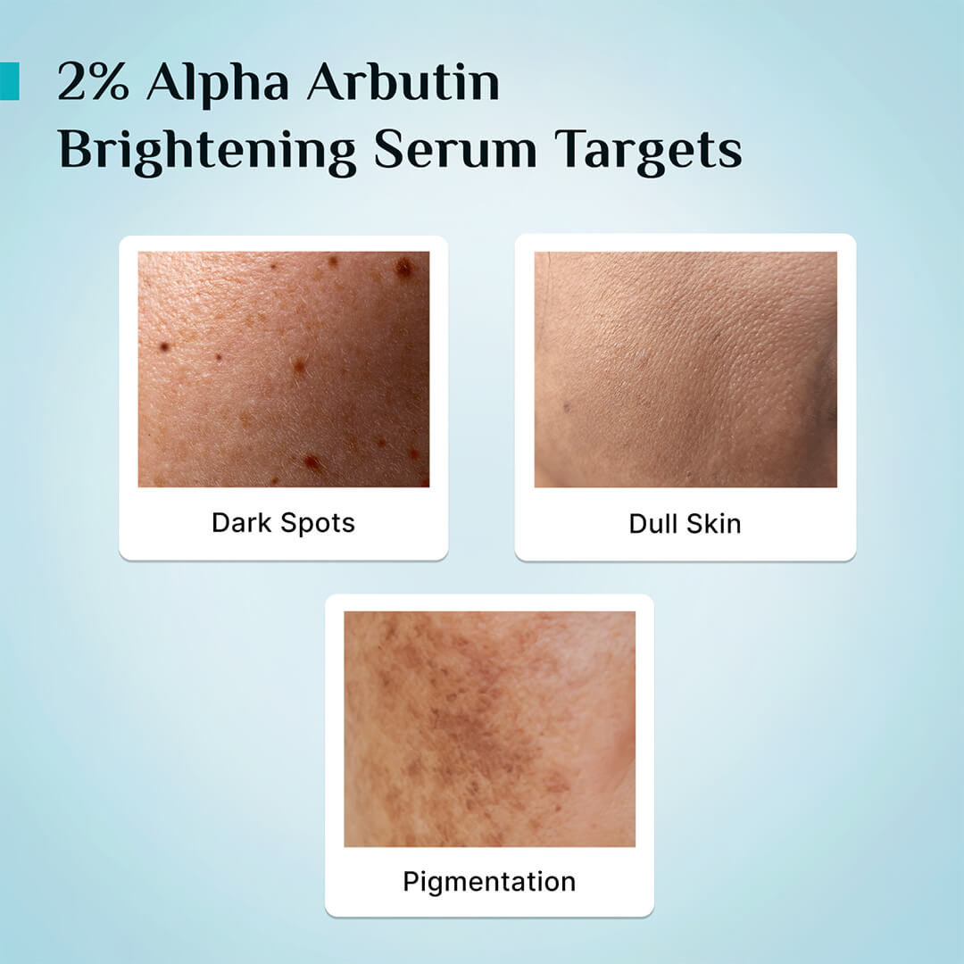 2% Alpha Arbutin Brightening Serum