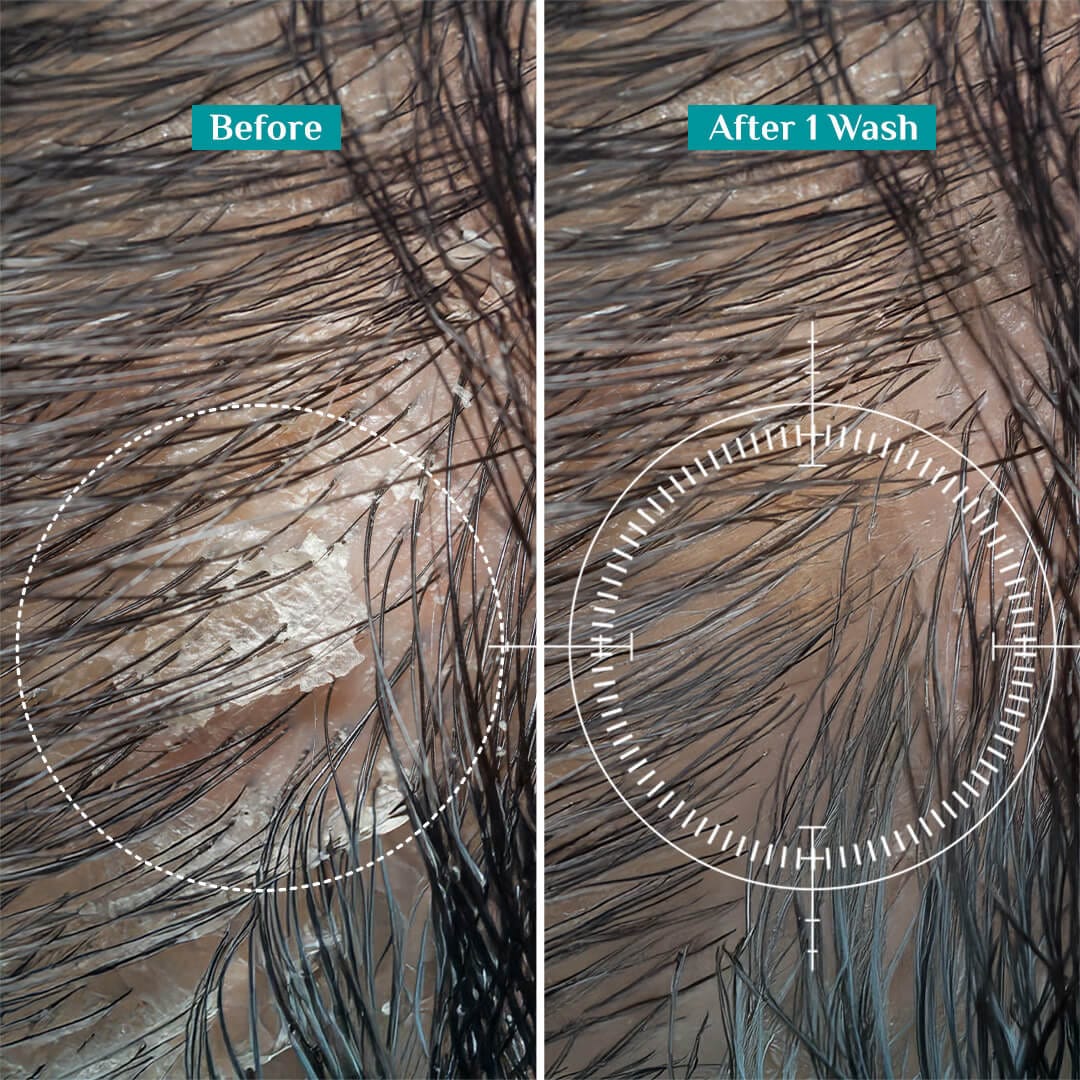 Australian Tea Tree Anti-Dandruff Conditioner