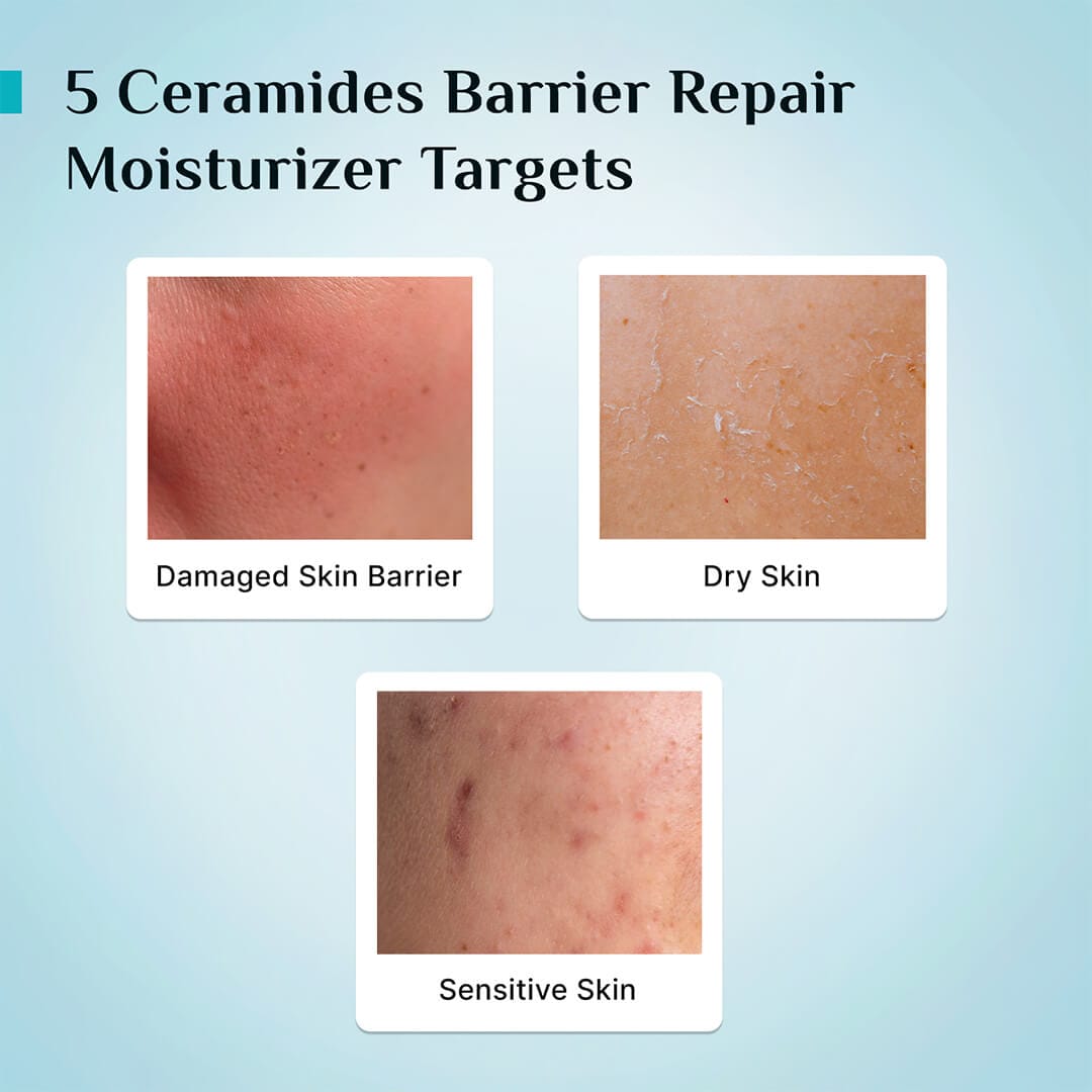 5 Ceramides Barrier Repair Moisturizer