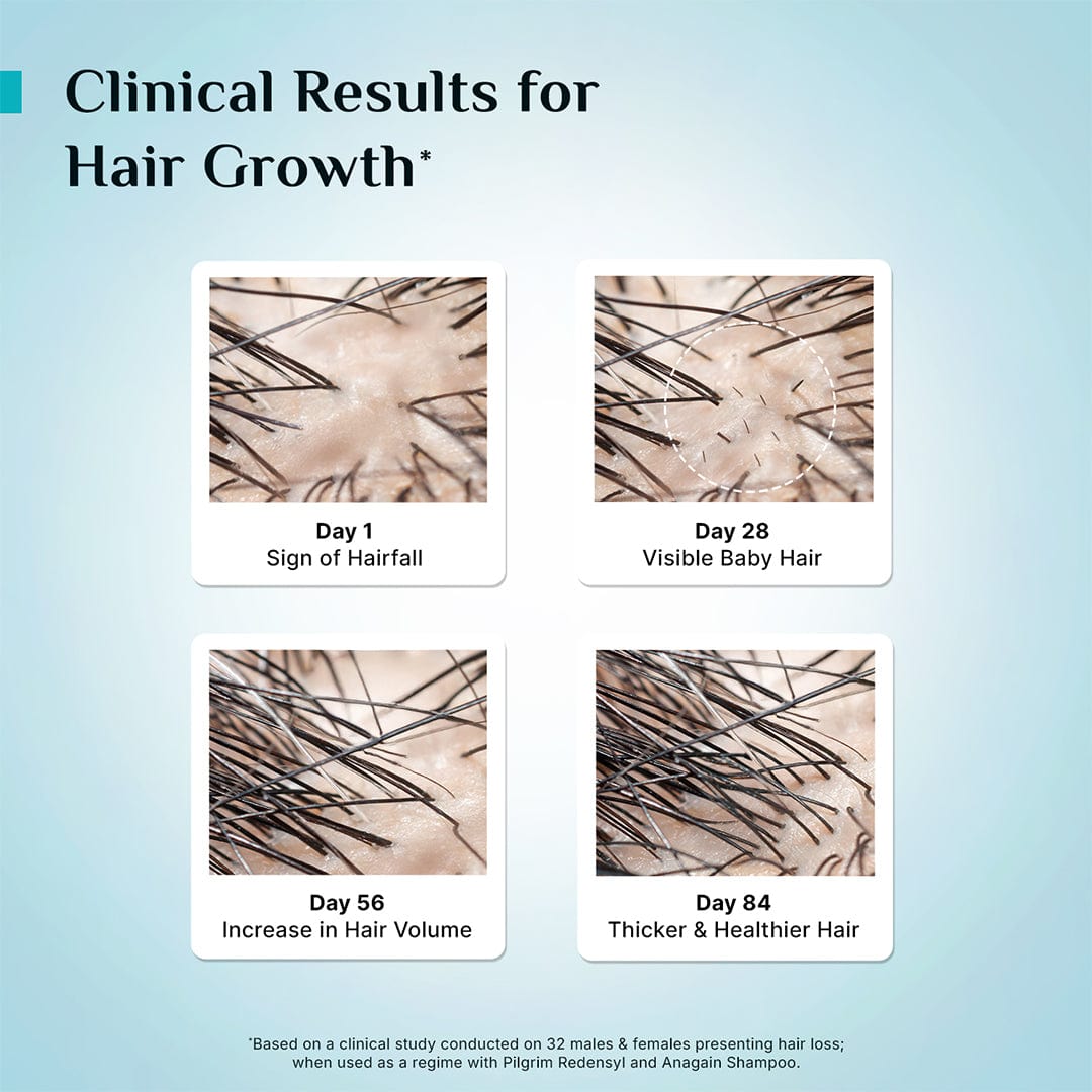 3% Redensyl & 4% Anagain Advanced Hair Growth Serum 100 ml