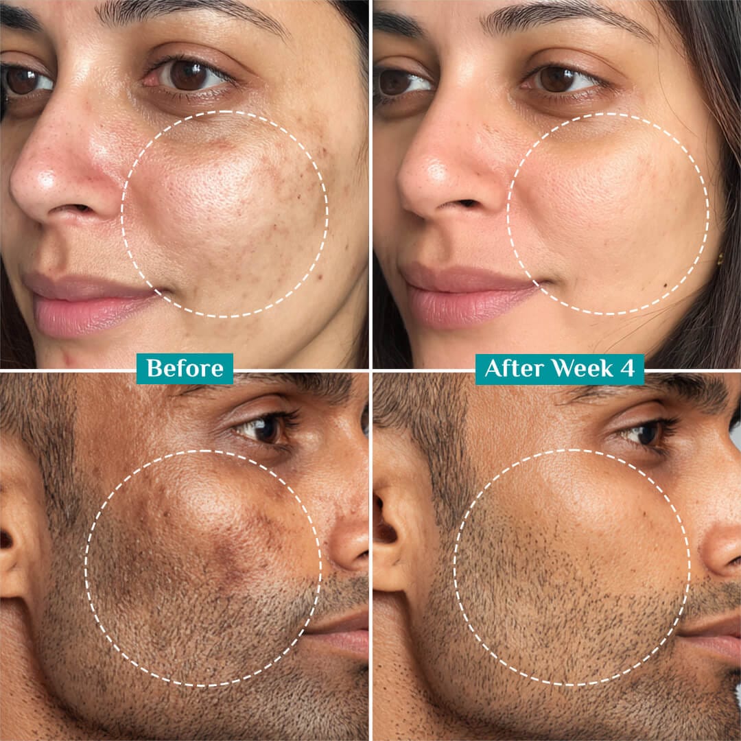 15% Vitamin C Face Serum For Advanced Brightness (20 ml)