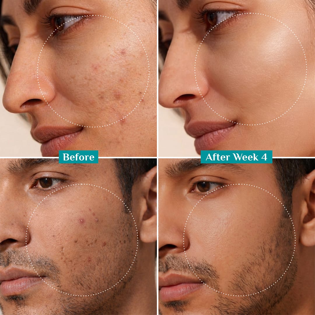 10% Niacinamide Face Serum With Kojic Acid & Korean Rice Water