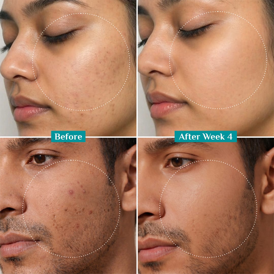 10% Niacinamide Face Serum With Kojic Acid & Korean Rice Water