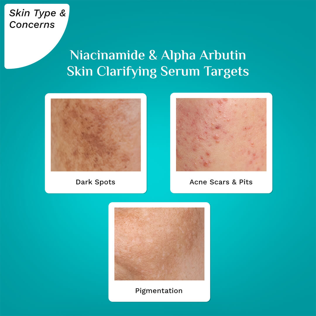 Niacinamide & Alpha Arbutin Skin Clarifying Serum